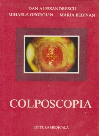 Colposcopia