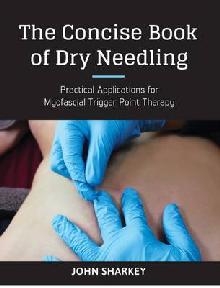 Concise Book of Dry Needling