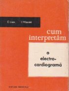 Cum interpretam o electrocardiograma