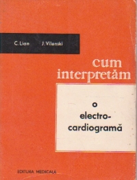 Cum interpretam o electrocardiograma