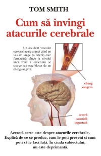 Cum sa invingi atacurile cerebrale