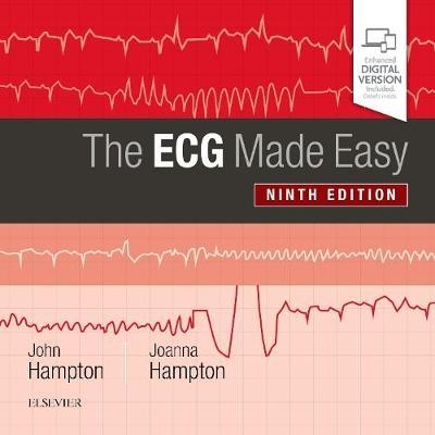 ECG Made Easy