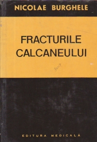 Fracturile calcaneului