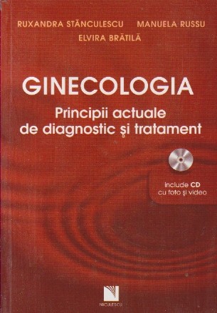 Ginecologia - Principii actuale de diagnostic si tratament (Include CD cu foto si video)