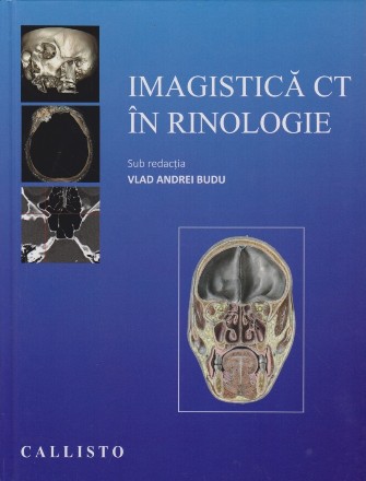 Imagistica CT in rinologie