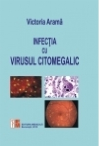 Infectia cu virusul citomegalic