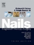 Nails : Diagnosis, Therapy, Surgery