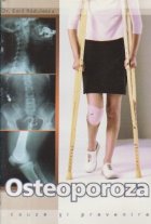 Osteoporoza Cauze prevenire