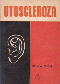 Otoscleroza