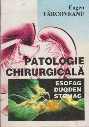 Patologie chirurgicala - esofag, duoden, stomac