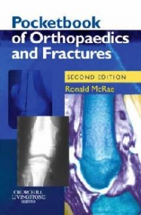 Pocketbook Of Orthopaedics & Fractures