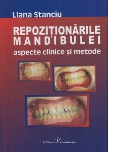 Repozitionarile mandibulei. Aspecte clinice si metode