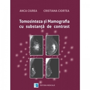 Tomosinteza si mamografia cu substanta de contrast