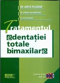 Tratamentul edentatiei totale bimaxilare