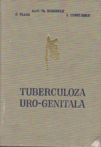 Tuberculoza uro - genitala