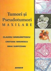 Tumori si pseudotumori maxilare