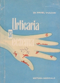 Urticaria si eczema