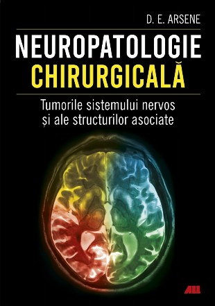 neuropatologie_chirurgicala-c1_1.jpg